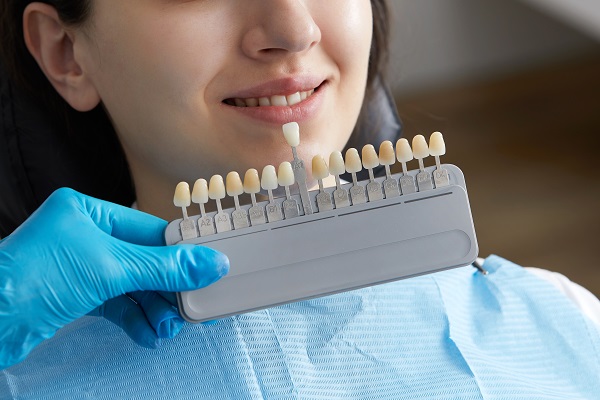 FAQs About CEREC® Crowns