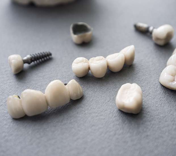 Danvers The Difference Between Dental Implants and Mini Dental Implants